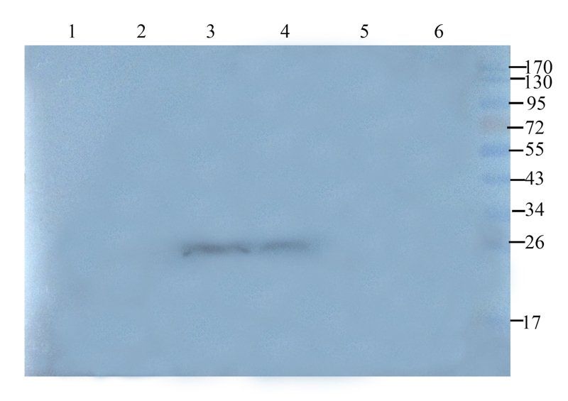 VEGF antibody