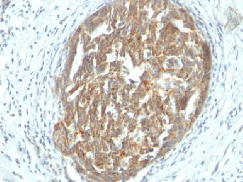VEGFA Antibody
