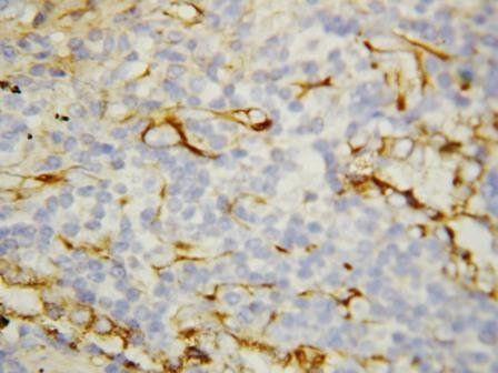 VEGF Receptor 1/FLT1 Rabbit Polyclonal Antibody