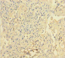 KDR Antibody