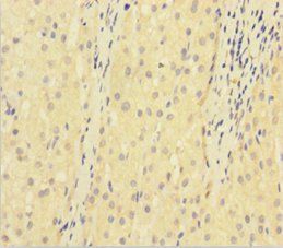 KDR Antibody