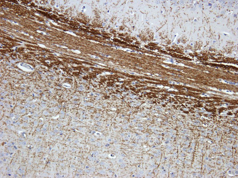 VEGFR3 antibody