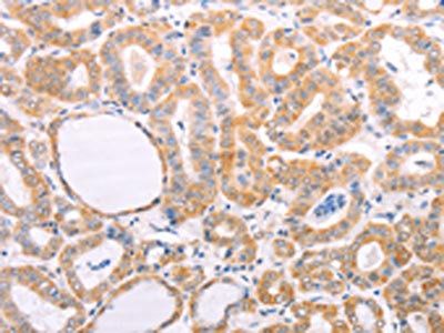 VHL Antibody