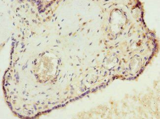 VHLL Antibody