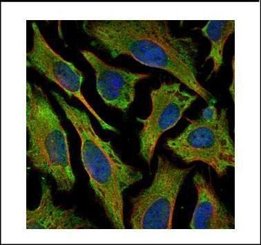 Villin Rabbit Polyclonal Antibody