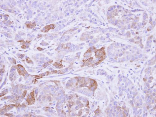 Villin Rabbit Polyclonal Antibody