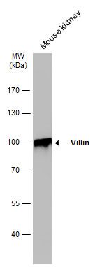 Villin Rabbit Polyclonal Antibody
