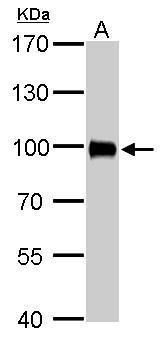 Villin Rabbit Polyclonal Antibody