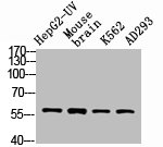 VIM Antibody