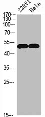 VIM Antibody