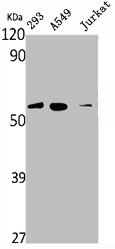 VIM Antibody