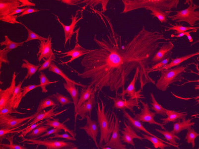 VIM Antibody