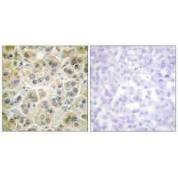 VIM Antibody