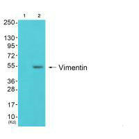 VIM Antibody