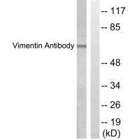 VIM Antibody