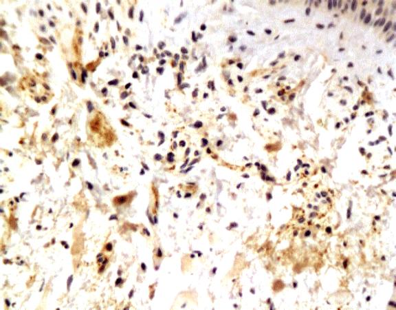 VIP Rabbit Polyclonal Antibody
