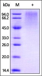 HRSV (A) Glycoprotein G Protein, His Tag
