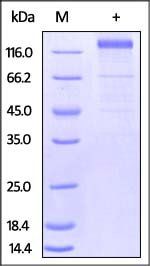 HCMV Glycoprotein B Protein, Fc Tag
