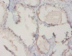 GC Antibody