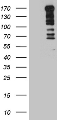 Vitamin D Binding protein Antibody