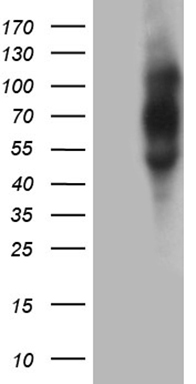 Vitamin D Binding protein Antibody