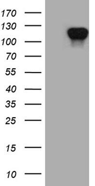 Vitamin D Binding protein Antibody