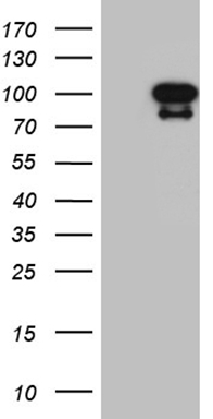 Vitamin D Binding protein Antibody