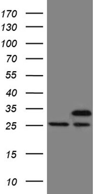 Vitamin D Binding protein Antibody