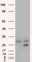 SLC18A2 Antibody