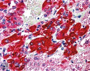 VMAT2/SLC18A2 Antibody