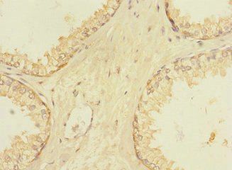 VN1R5 Antibody
