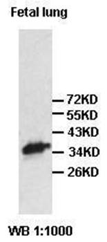 VPS26 Rabbit Polyclonal Antibody