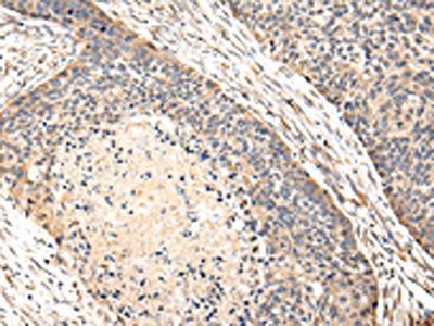 VPS35 Antibody