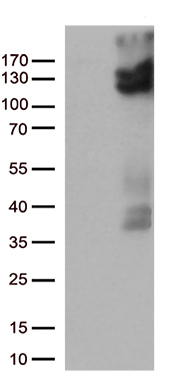 TRPV2 Antibody