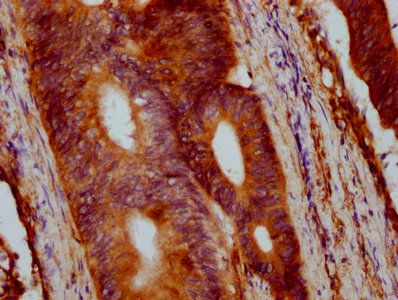 VTN Antibody