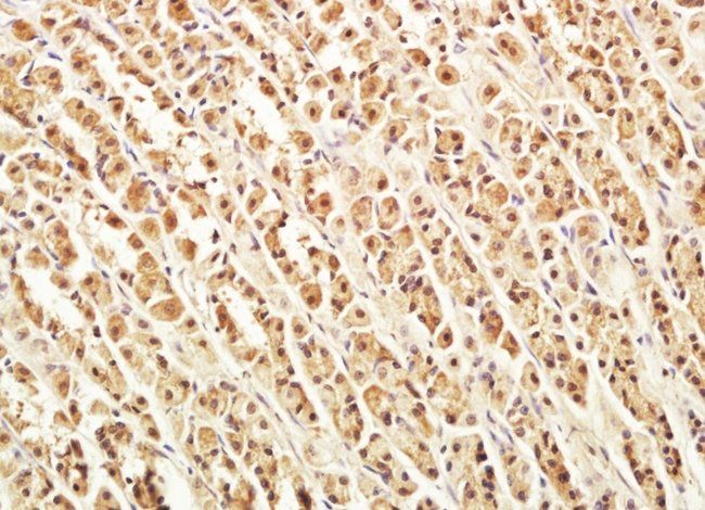 VWCE Rabbit Polyclonal Antibody
