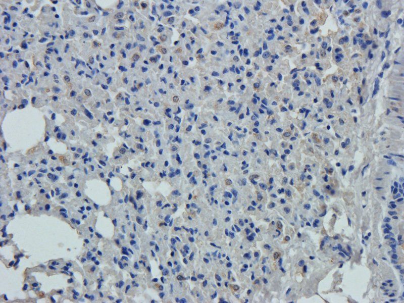 vWF antibody