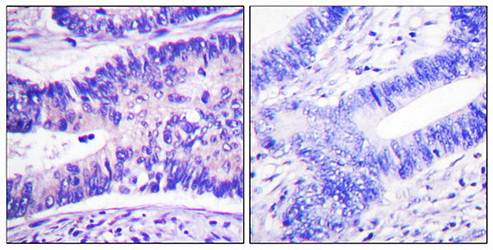 WAVE1 (Phospho-Tyr125) Antibody