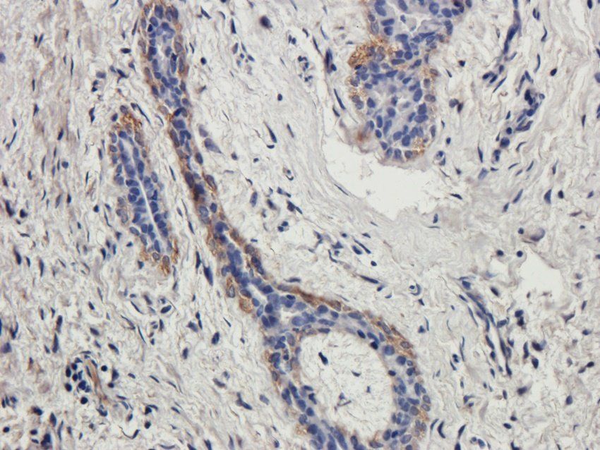 WDFY1 antibody