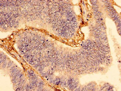 WDFY3 Antibody