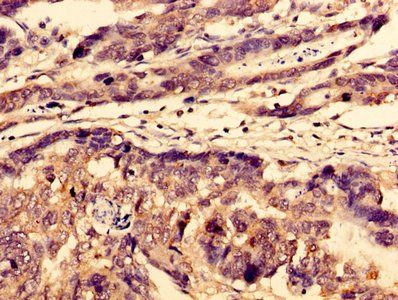 WDFY3 Antibody