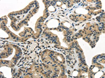 WDR36 Antibody