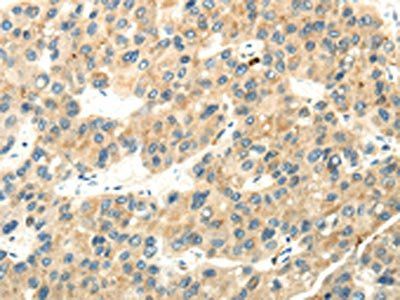 WDR36 Antibody