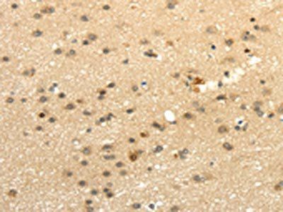 WDR36 Antibody