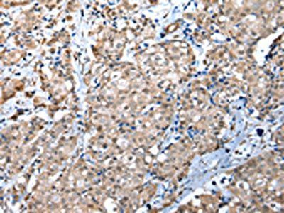 WDR4 Antibody
