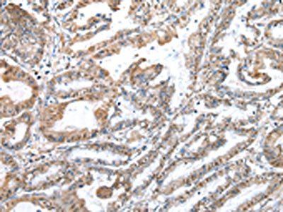 WDR5 Antibody