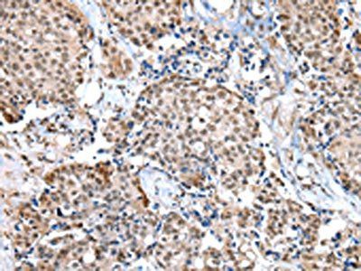 WDR5 Antibody