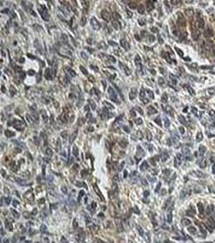 WNK1 Rabbit Polyclonal Antibody