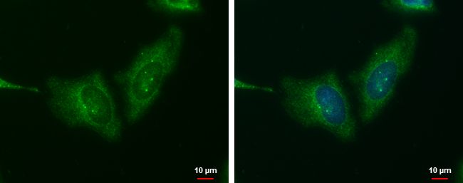 Wnt11 Rabbit Polyclonal Antibody