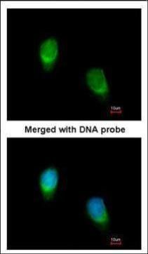 Wnt11 Rabbit Polyclonal Antibody